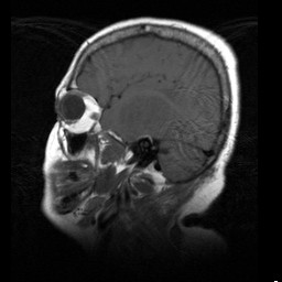 Kontrastní látky v MRI Kontrastní látky jsou látky, které jsou vpraveny do zobrazované oblasti (orgán, tkáň či krevní řečiště, kde zvýší rozdíl (kontrast) mezi zdravou a patologickou oblastí nebo