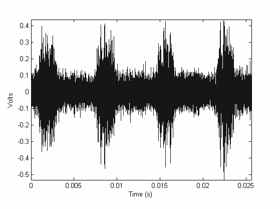 Metody sledování poruch ložisek / Methods of bearing surface checking Ucho a šroubovák Vibrační spektrum, vysoké kmitočty Obálka spektra