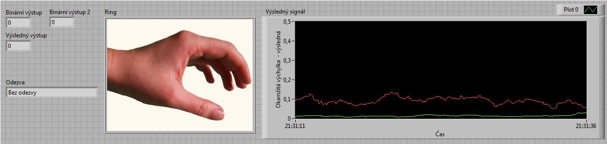 I při opakovaných měřeních a různém umístění elektrod nedosahovala výchylka stejných hodnot jako signál první (EMG_1 kanál 3).