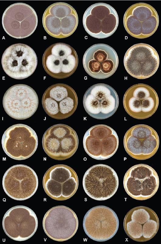 Aspergillus sekce Nigri