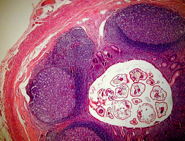 nejasné gastrointestinální obtíže Foto Miroslav Förstl a MUDr.