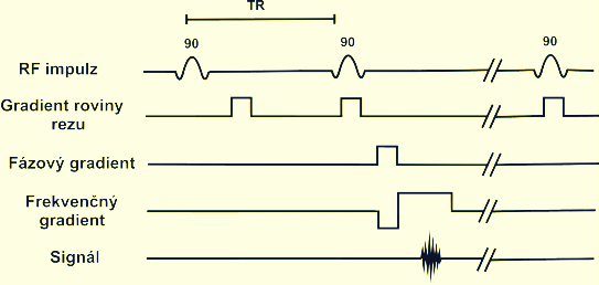 Obr. 1-9Schéma SRT [10] Spolu s IRT patří SRT a SPT do kategorie dnes již opouštěných metod.