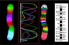 Metody studia chromozomů Rozlišení podle velikosti a typu barvení mitotických chromozomů ( karyologie )