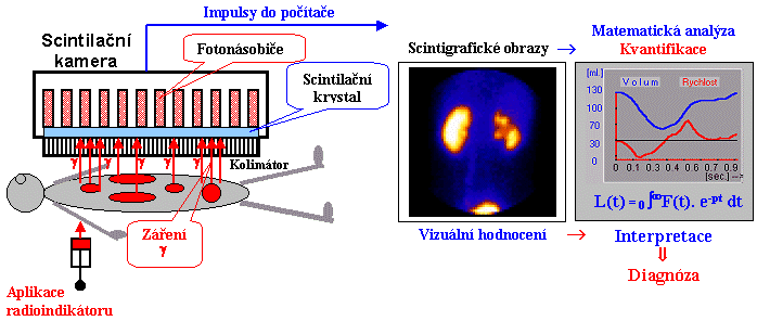 Molekulární gamagrafické zobrazení + Biologicky cílená radionuklidová terapie - závěr, perspektivy - Účinný nástroj ke specifické diagnostice a cílené léčbě (nejen) onkologických onemocnění Vývoj a