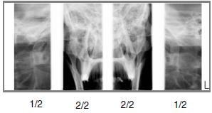 PROGRAMY Dvojitý PA TMJ program Posterior-anterior snímkování zavřených(1/2) a otevřených (2/2) TMJ kloubů. Planmeca ProMax 2D S3 a Planmeca ProMax 3D Pozici a úhel snímkování lze nastavit.