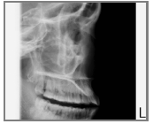 PROGRAMY Posterior-anterior lineárni sinus expozice PA