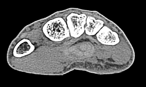 Modely geometrie jsou vytvářeny zpracováním informací ze zařízení z oblasti zobrazovacích metod. V současné době se především jedná o CT, MRI, MikroCT, Sono atd.