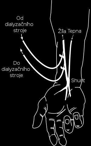 Příloha3: Prostá radio -