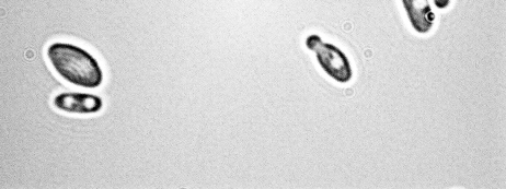 Vinařské kvasinky non-saccharomyces Pichia spp. Debaryomyces spp. http://www.kimchitech.co.kr Rhodotorula spp. http://www.tehnologijahrane.