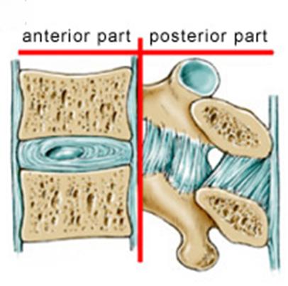 2 sloupcový biomechanický model Přední sloupec tlakový - obratlové tělo, disk a podélné vazy Zadní sloupec