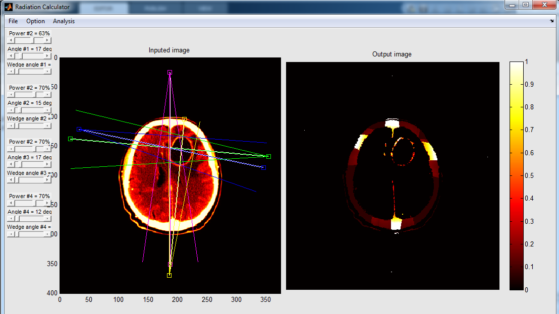 Obrázek 12 Je možné umístit až 4 zdroje záření Hlavní částí programu je levý Axes Output image. V něm je modelován průchod záření objektem. Tato část je vysvětlena programově i fyzikálně v kapitole 7.