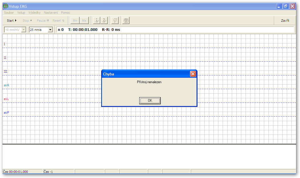 Záznam EKG, svody I,II,III, avr, avl, avf: Někdy se může objevit hlášení Přístroj nenalezen