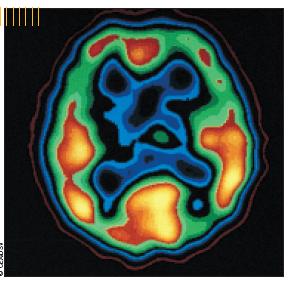 Str. 2 Obsah Definice radioaktivity 4 Radioaktivita, přirozená vlastnost některých atomů 5 Měření radioaktivity 6