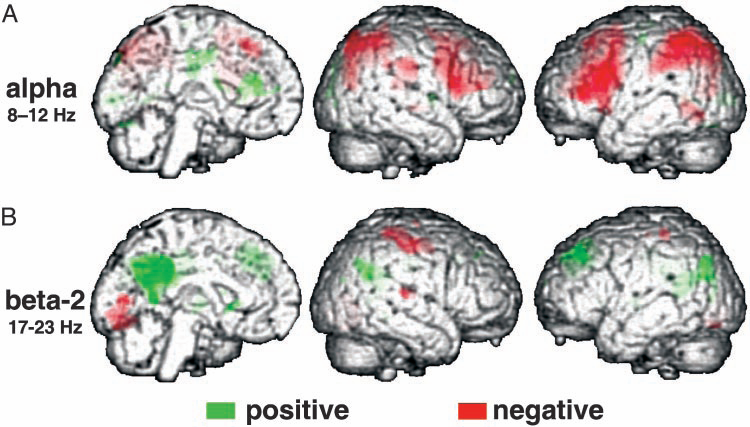 BRAIN RHYTMS resting state data (awake rest) korelace výkonu ve frekvenčním pásmu EEG signálu s BOLD signálem ALFA desynchronizace při zapojení pozornostních mechanismů pozitivní korelace v oblasti