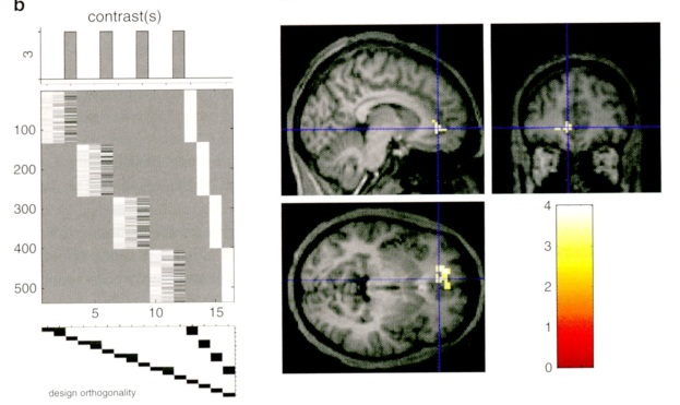 ERP A BOLD zkoumání vztahu mezi parametry ERP a BOLD Benar et al.