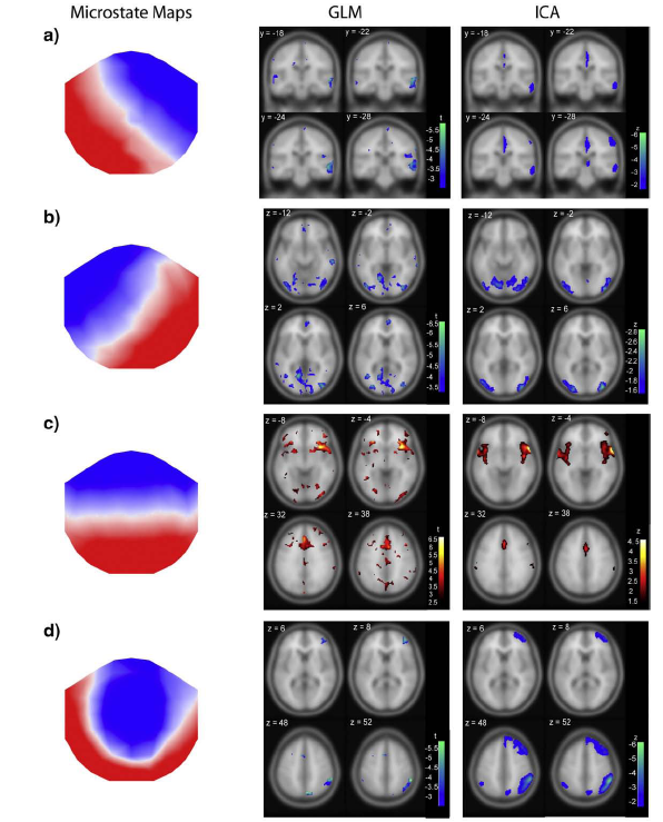 EEG MICROSTATES skalpové EEG existence 4 typických stavů topografie skalpového EEG stavy