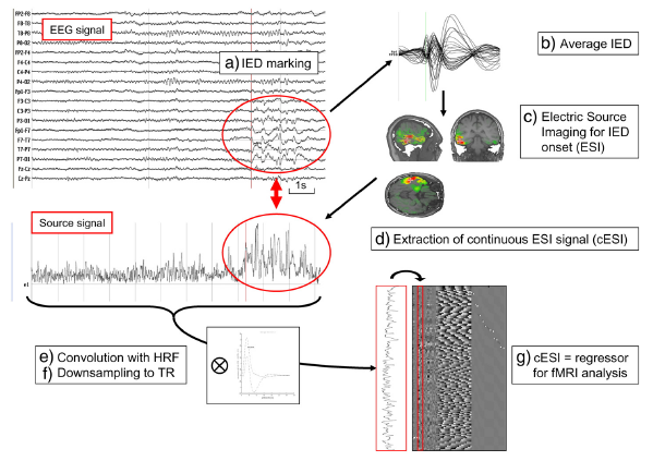 DALŠÍ METODY ZPRACOVÁNÍ EEG-FMRI iktální EEG-fMRI výzkum bolesti využití Source