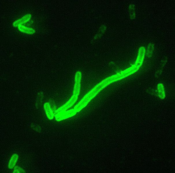 BAKTERIE MORU YERSINIA PESTIS ELEKTRONOVÝM MIKROSKOPEM INFIKOVANÁ KRYSÍ BLECHA MOR (ČERNÁ SMRT) CHOROBA, KTERÁ DECIMOVALA STŘEDOVĚKÉ POPULACE, VYSKYTUJE SE VE DVOU FORMÁCH