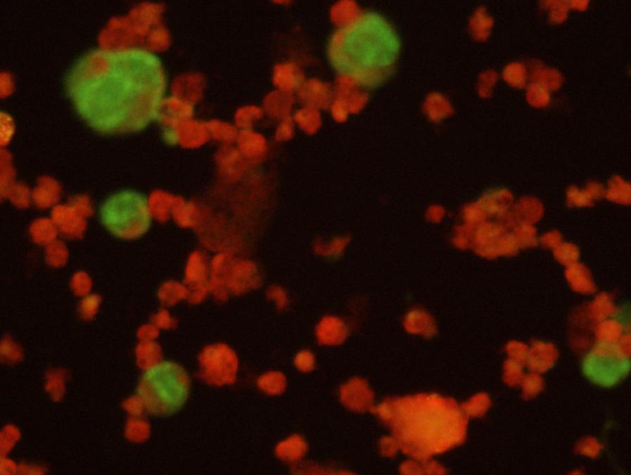 Latence a reaktivace Latence: Integrace do telomerových oblastí buněčných chromozómů pomocí homologní rekombinace (TRS v koncových DR ) Latentní protein: U94/rep Latentní RNA (