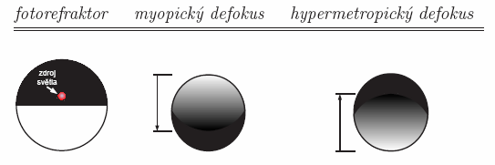 relativního defokusu oka, resp. ametropie, je v blízkosti dead zone méně ovlivněný aberacemi oka [6].