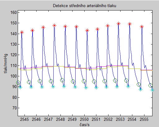 Obr. 14.: Ukázka detekce středního arteriálního tlaku 4.