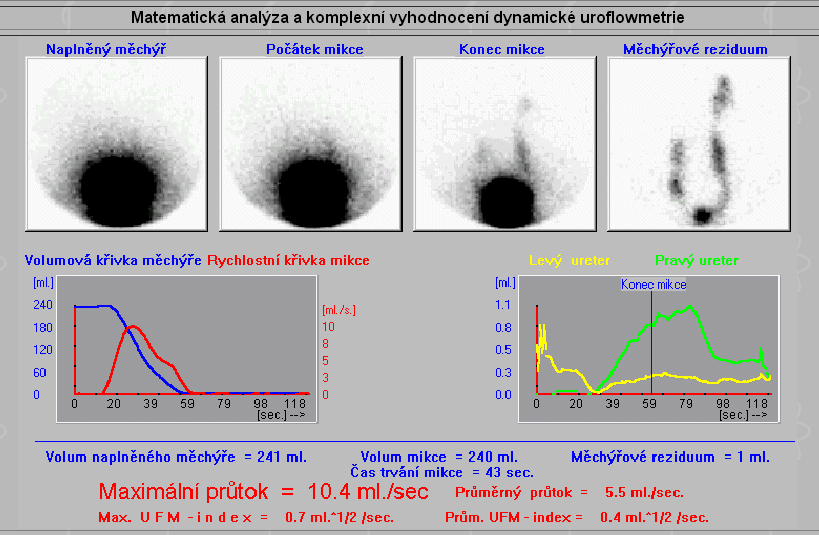 Obrázek 8: Dynamická uroflowmetrie (2) 2.9.