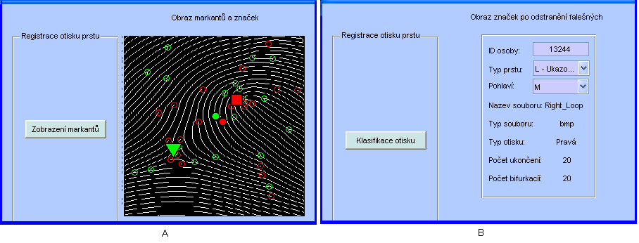 3. Stiskem tlačítka Poincaré index jsou vypočítány rozdíly diferencí a jejich hodnoty vykresleny. Je vytvořena mapa Poincaré indexu. 4.