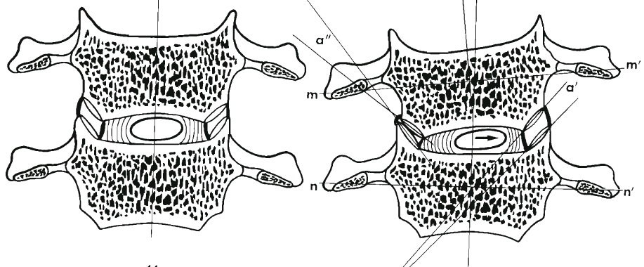 kraniálně vyrůstá různě dlouhý čep - dens axis (Dylevský, 20