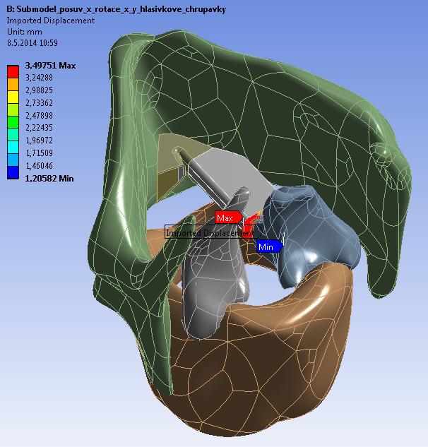 4 Výpočtové modelování v Ansys Classic II Protože se nepodařilo v prostředí ANSYS Workbench zajistit správnou funkci kontaktu mezi hlasivkami (pronikání sítí, nekonvergence) byla úloha submodelingu