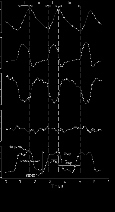 Flow limited patient