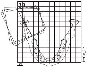 GRAFICKÝ OVLÁDACÍ PANEL Dvojitý PA Dvojitý PA: Posteriorní snímek otevřených a zavřených TMJ kloubů (přednastavený úhel: 60 ) Dvojitý laterál-pa Dvojitý laterál-pa: Laterální a posterioanteriorní
