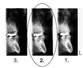 GRAFICKÝ OVLÁDACÍ PANEL V manuelním programu se můžete rozhodnout kolik snímků budete mít na jednom radiografu. Minimum je jeden a maximum tři.