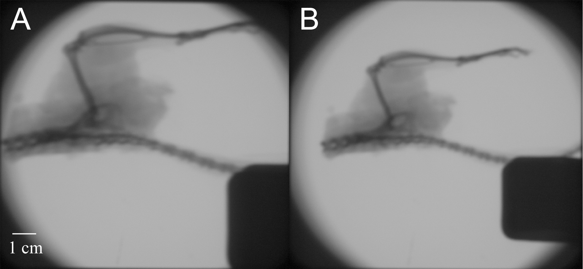 Hlava vzdálenosti od zdroje: 5 cm (A), 14 cm (B) Noha vzdálenosti od zdroje: 17 cm (A), 25 cm (B) Vidíme, že i při zobrazování poměrně slabou rentgenkou záření dobře proniká tkání.