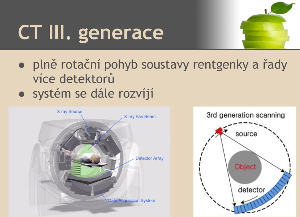 pohyb soustavy rentgenky