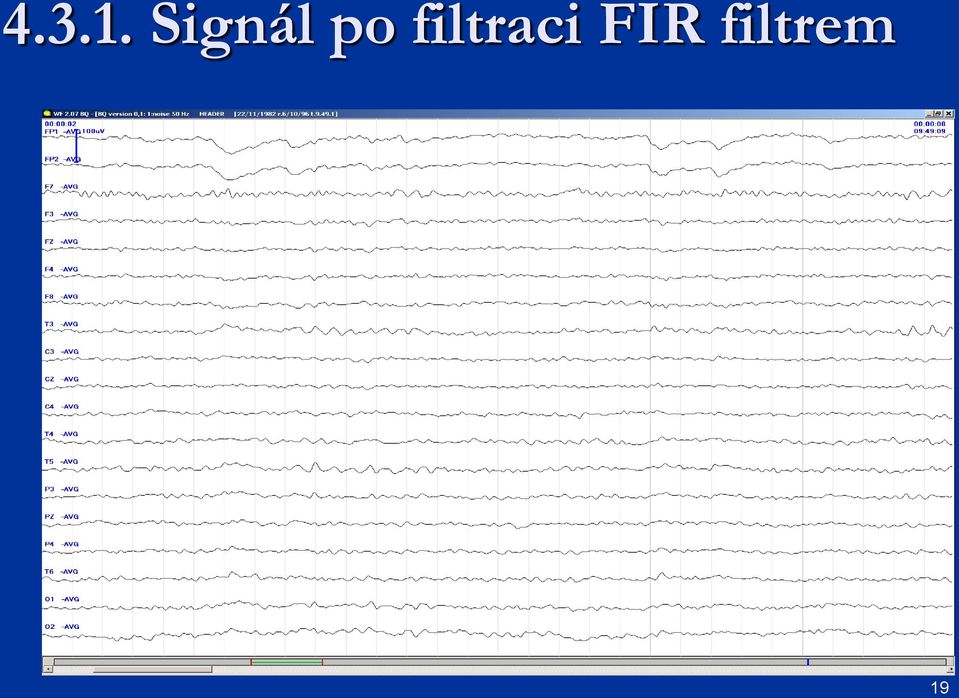 filtraci