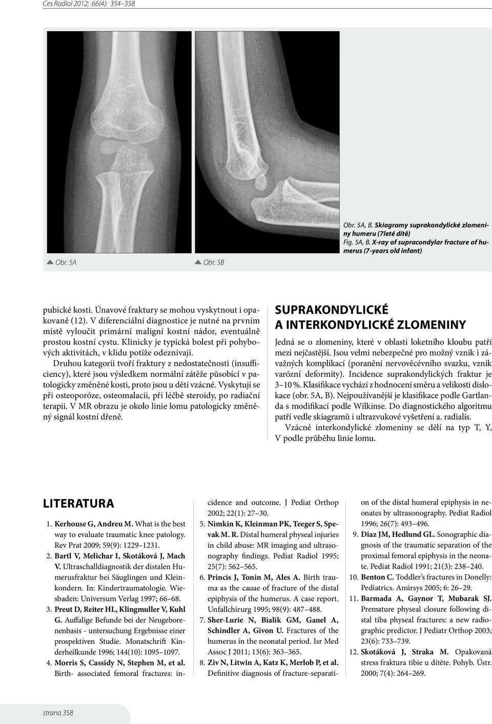 Klinicky je typická bolest při pohybových aktivitách, v klidu potíže odeznívají.