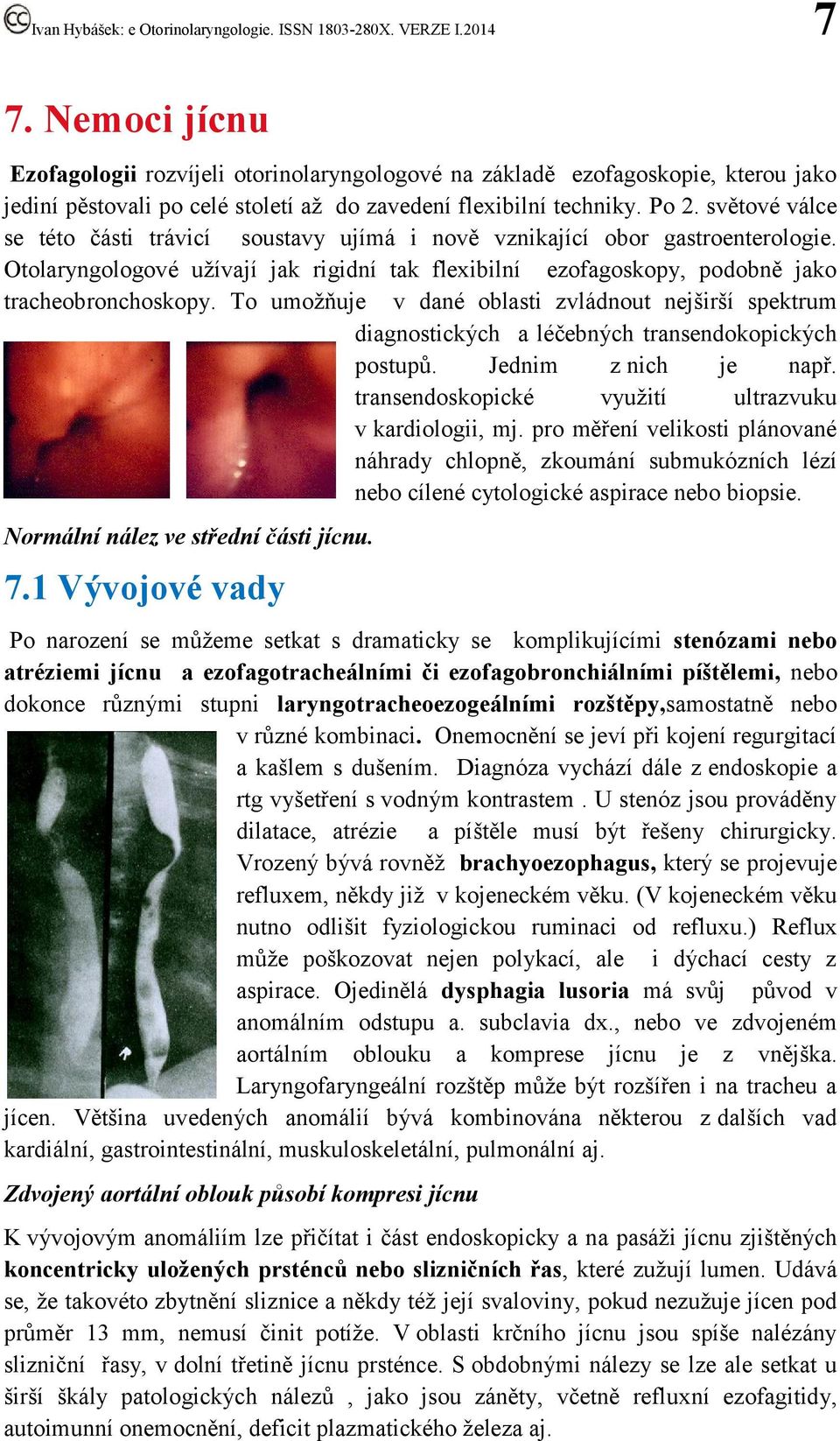 To umožňuje v dané oblasti zvládnout nejširší spektrum diagnostických a léčebných transendokopických postupů. Jednim z nich je např. transendoskopické využití ultrazvuku v kardiologii, mj.