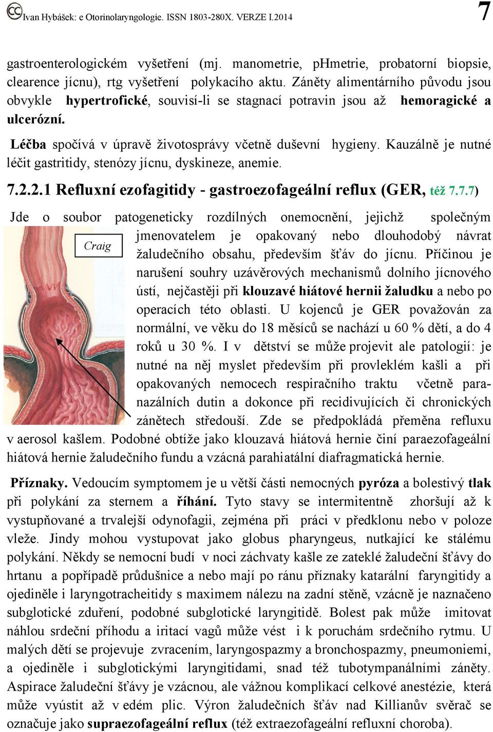 Kauzálně je nutné léčit gastritidy, stenózy jícnu, dyskineze, anemie. 7.