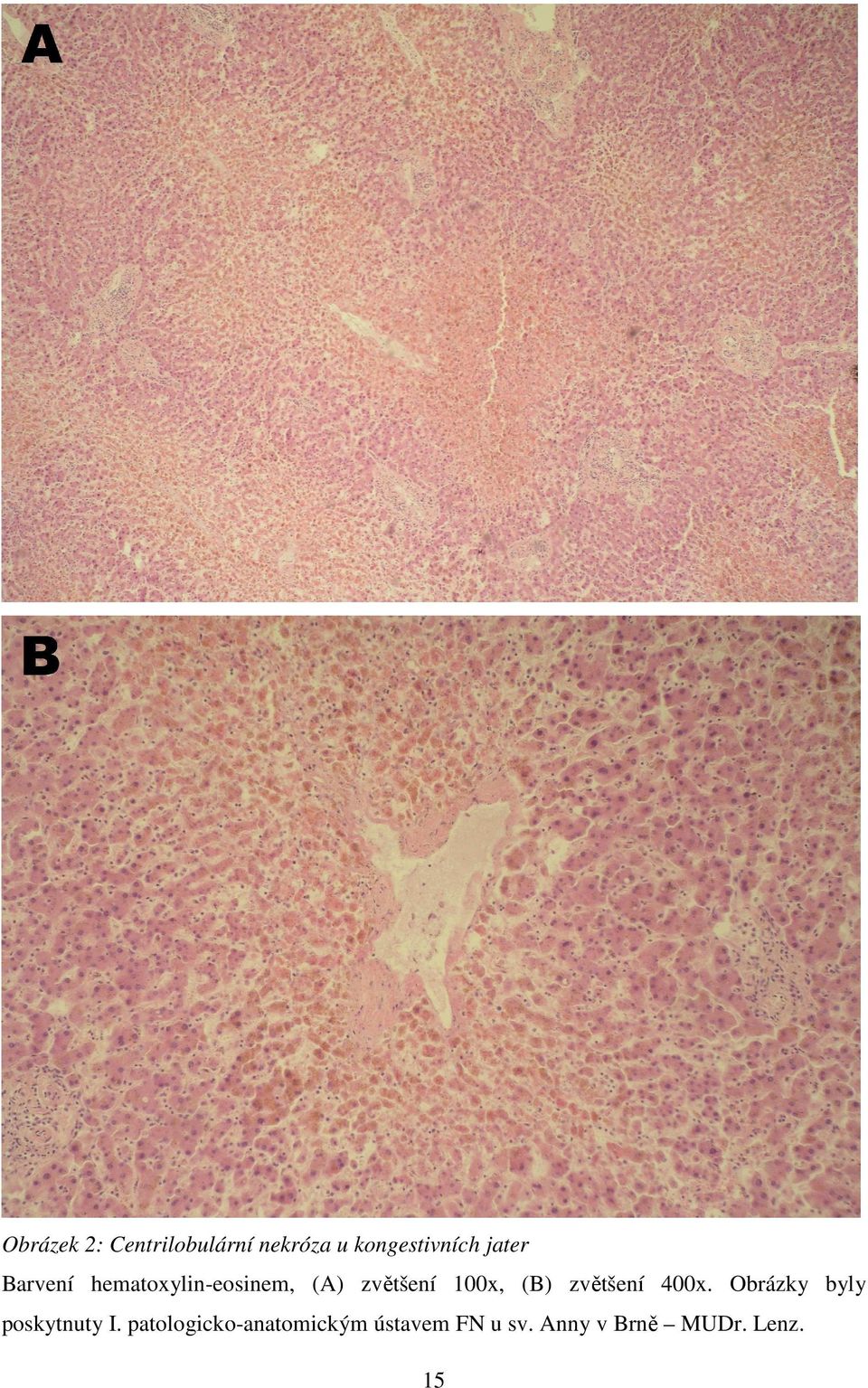 (B) zvětšení 400x. Obrázky byly poskytnuty I.