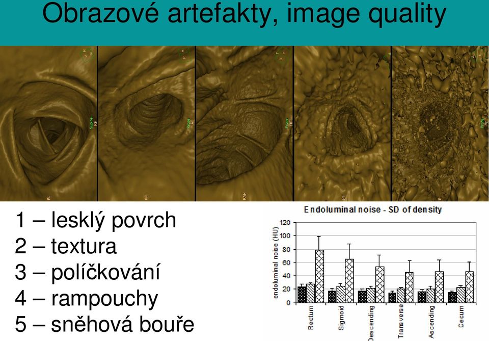 textura 3 políčkování 4