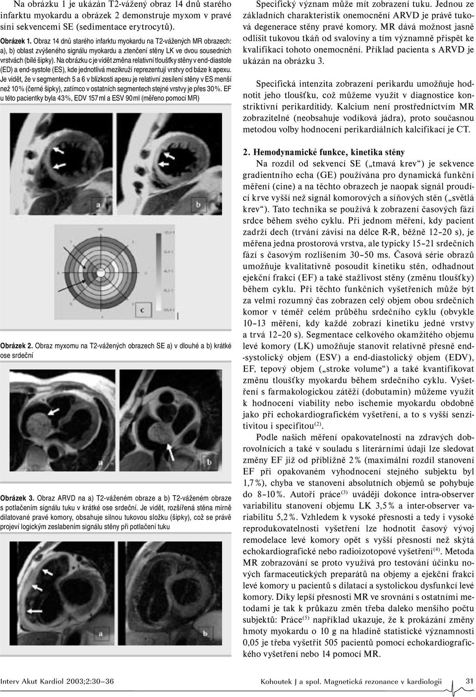 Na obrázku c je vidět změna relativní tloušťky stěny v end-diastole (ED) a end-systole (ES), kde jednotlivá mezikruží reprezentují vrstvy od báze k apexu.