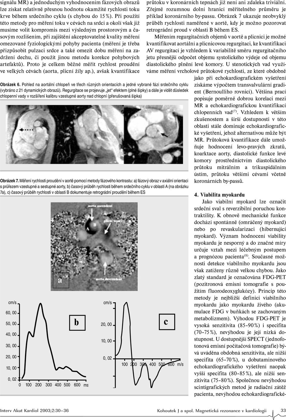 omezované fyziologickými pohyby pacienta (měření je třeba přizpůsobit pulzaci srdce a také omezit dobu měření na zadržení dechu, či použít jinou metodu korekce pohybových artefaktů).