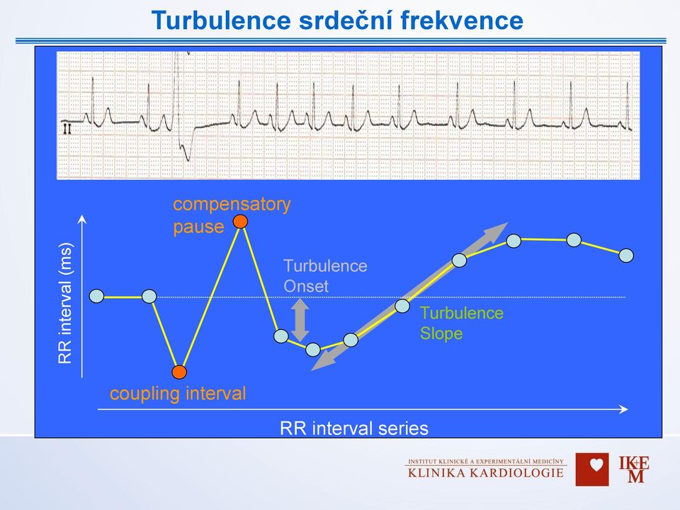 pause Turbulence Onset Turbulence