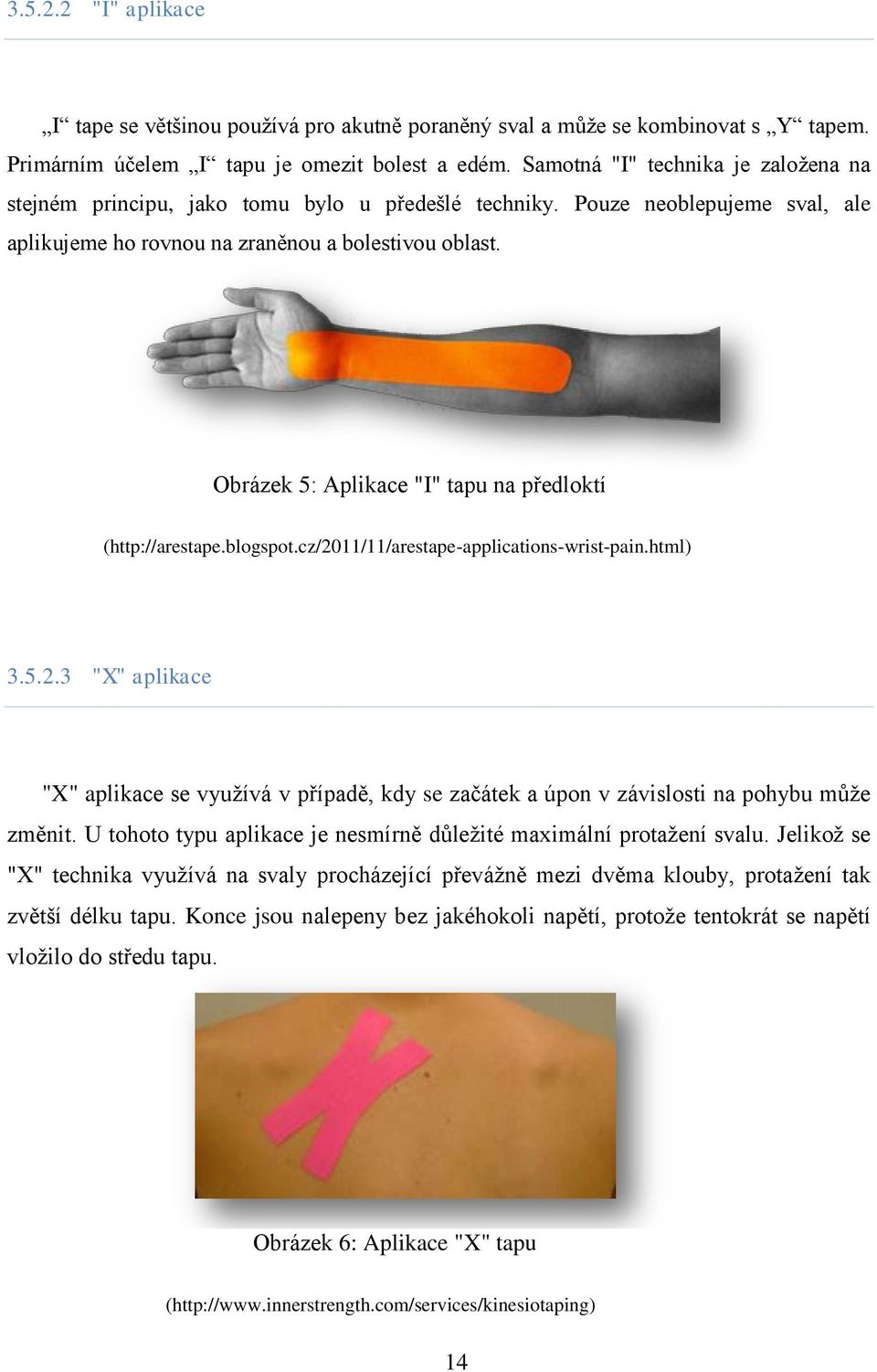 Obrázek 5: Aplikace "I" tapu na předloktí (http://arestape.blogspot.cz/2011/11/arestape-applications-wrist-pain.html) 3.5.2.3 "X" aplikace "X" aplikace se využívá v případě, kdy se začátek a úpon v závislosti na pohybu může změnit.