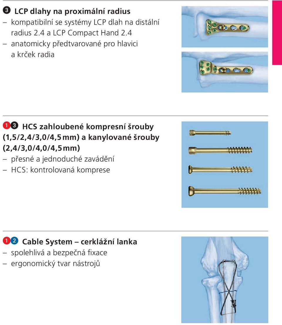 4 anatomicky předtvarované pro hlavici a krček radia HCS zahloubené kompresní šrouby