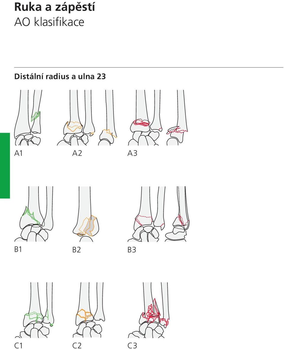 radius a ulna 23 A1