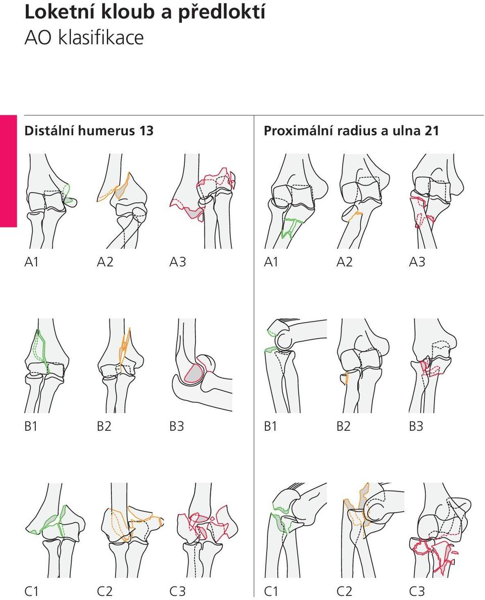 Proximální radius a ulna 21 A1 A2