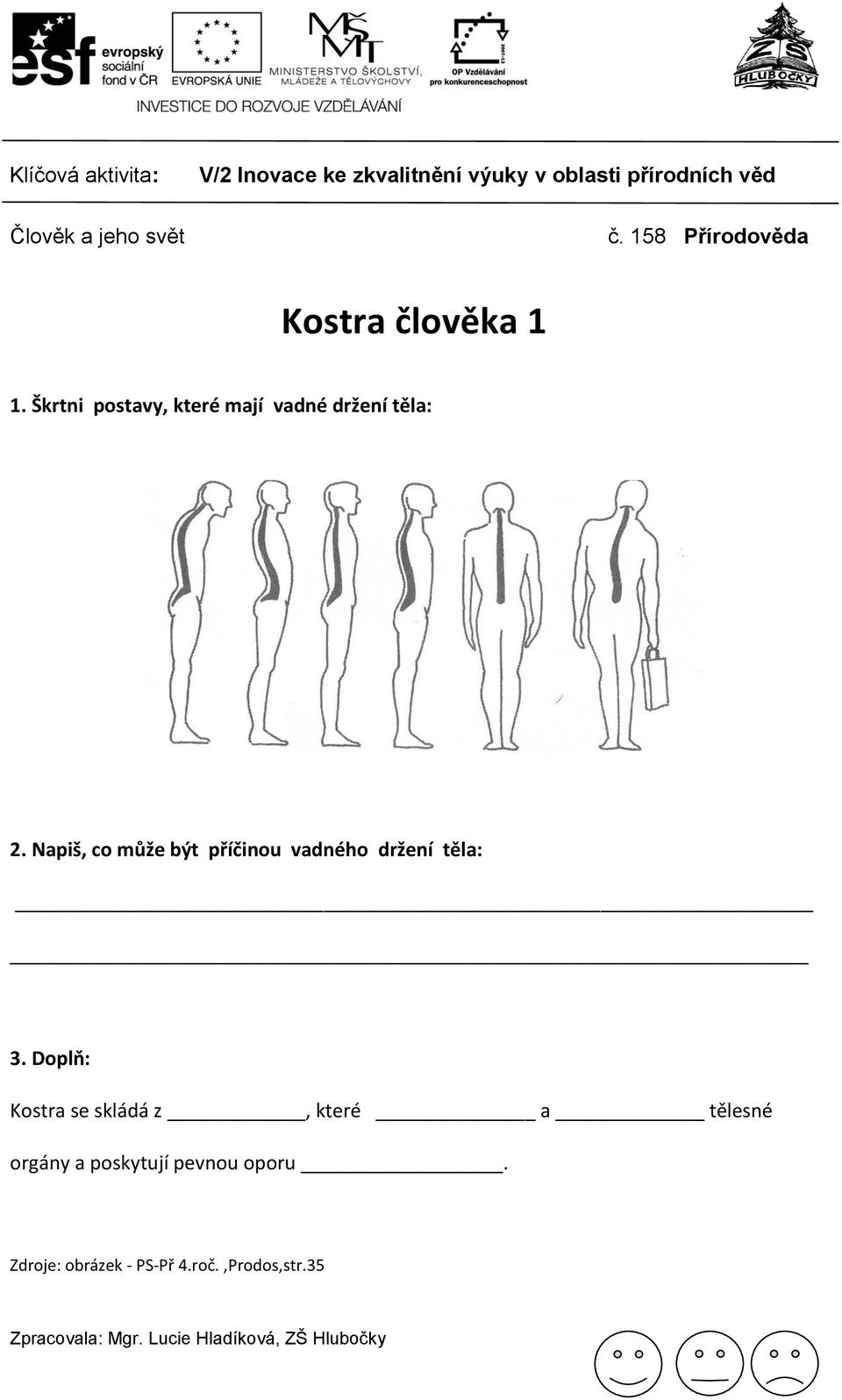 Napiš, co může být příčinou vadného držení těla: 3.