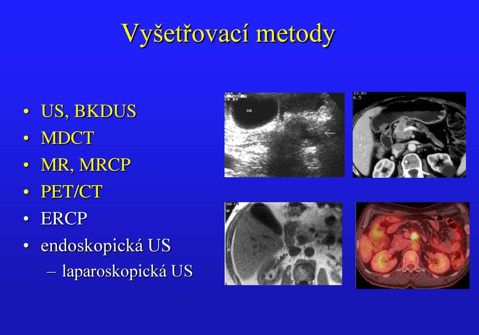 MRCP PET/CT ERCP