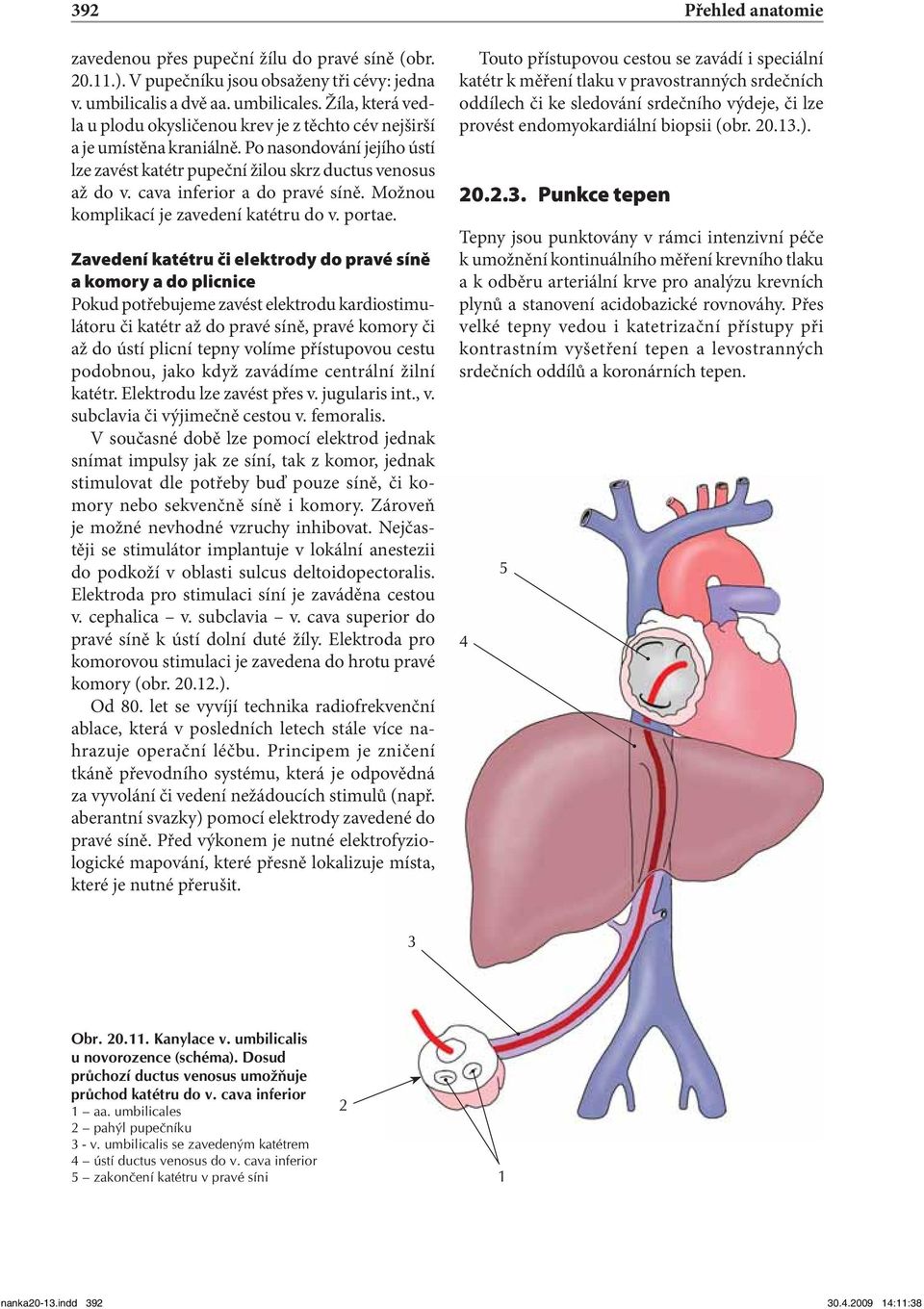 cava inferior a do pravé síně. Možnou komplikací je zavedení katétru do v. portae.